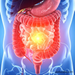 Dari Mual hingga Nyeri Perut: Tanda Batu Empedu Mengacaukan Pencernaan Anda