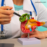 Batu Empedu Bisa Terbentuk Tanpa Gejala: Ini Penjelasannya