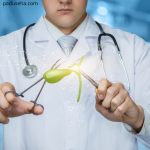 Efek Tubuh Tanpa Kantung Empedu: Apa yang Terjadi Setelah Operasi Kolesistektomi?