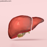 Batu Empedu Tanpa Gejala: Haruskah Dioperasi?