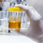 Warna Urin dan Feses Bisa Ungkap Masalah Empedu Anda