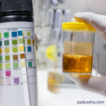 Perubahan Warna Urine dan Feses sebagai Tanda Batu Empedu Bermasalah