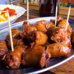 Mengapa Batu Empedu Bisa Terbentuk Meski Jarang Makan Lemak?