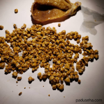 Perbedaan Gejala Batu Empedu Akut dan Kronis yang Perlu Anda Ketahui