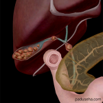 Apa yang Terjadi di Dalam Tubuh Saat Batu Empedu Mulai Bergerak?