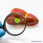 Bisakah Infeksi Empedu Dicegah? Ini Langkah-Langkah Pentingnya