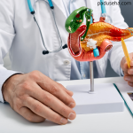 Batu Empedu yang Tidak Diobati: Apa Risiko Jangka Panjangnya?