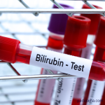 Batu Empedu Pigmen: Gangguan Empedu yang Berbeda dari Biasanya